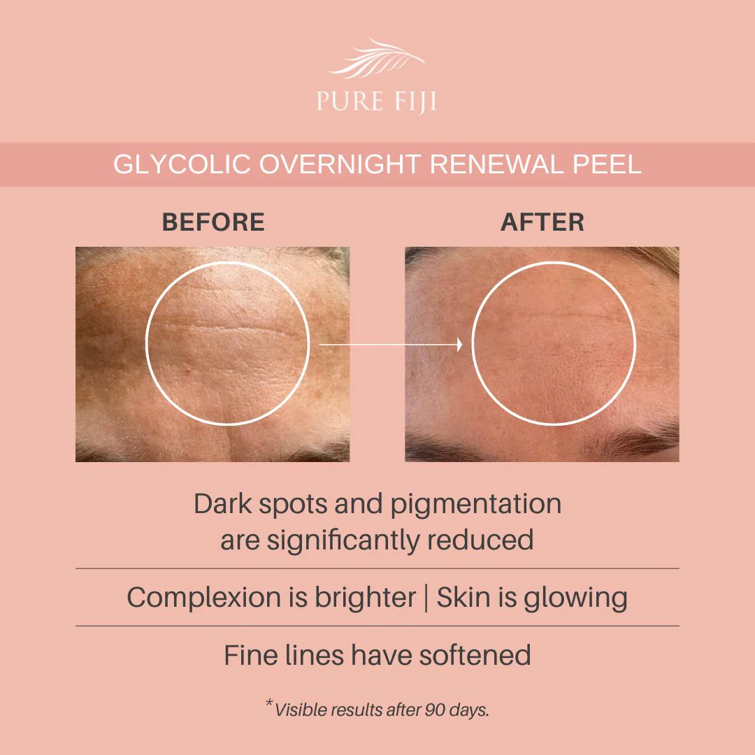 Glycolic Overnight Renewal Peel with Mandelic + Niacinamide (1oz/30ml) - Image 6