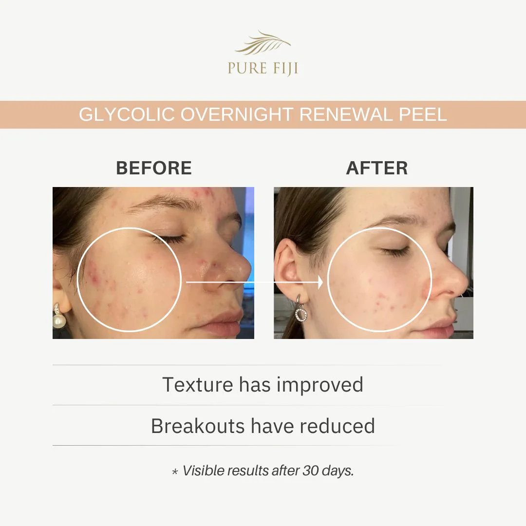 Glycolic Overnight Renewal Peel with Mandelic + Niacinamide (1oz/30ml) - Image 7