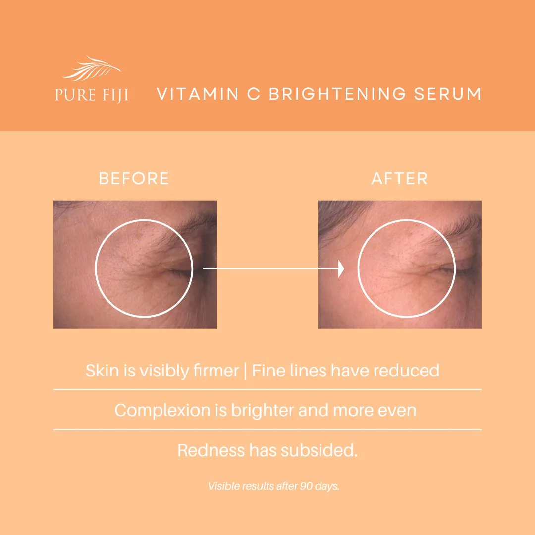 Kakadu Super Vitamin C Brightening Serum with Hyaluronate + Bakuchiol - Image 6